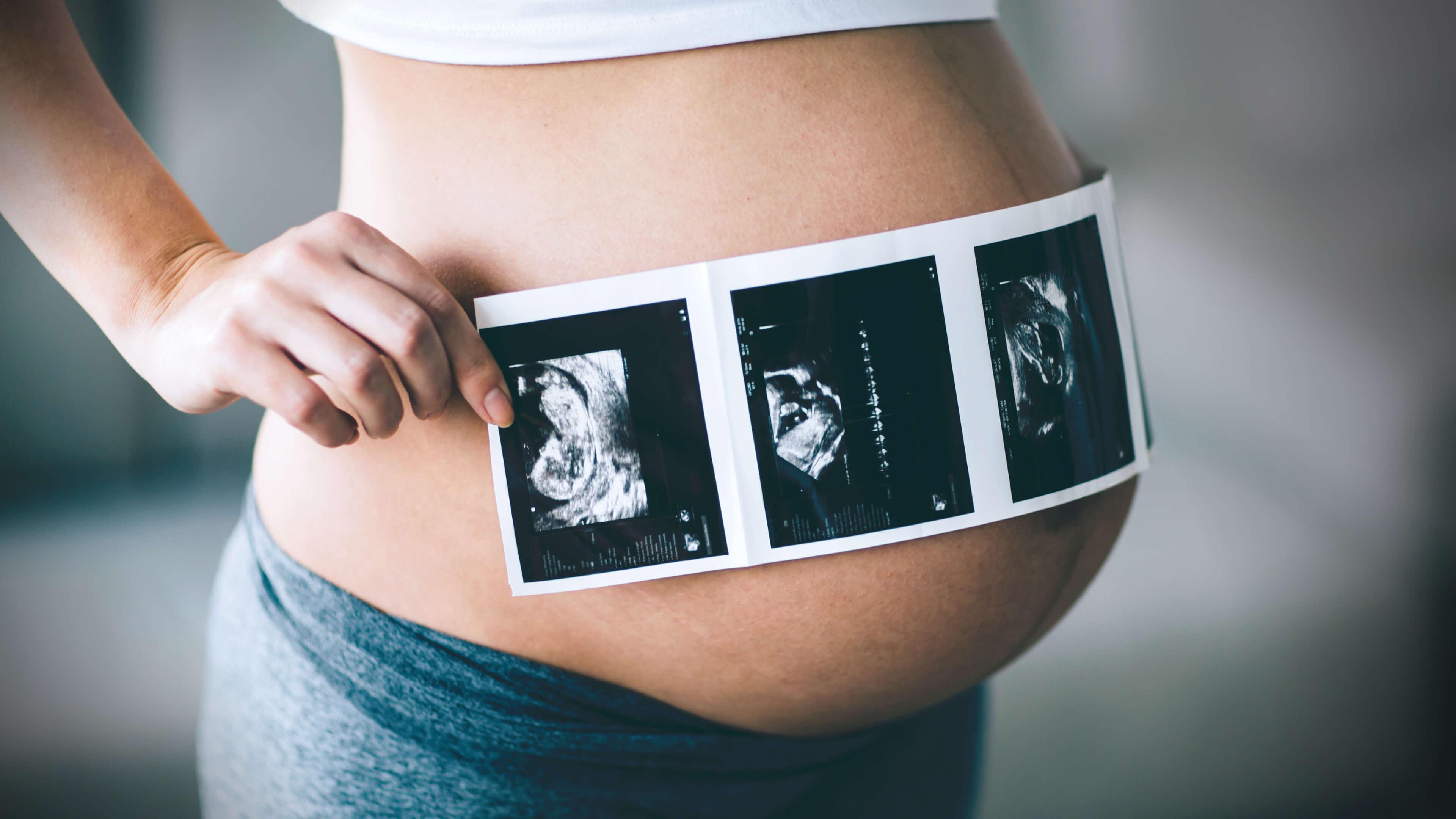 Беременность 3 5 года. Беременность. УЗИ беременных. Фотосессия беременной со снимком.
